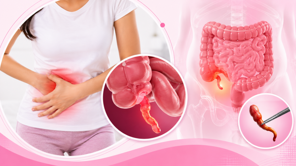 Appendix Surgery in Kaithal