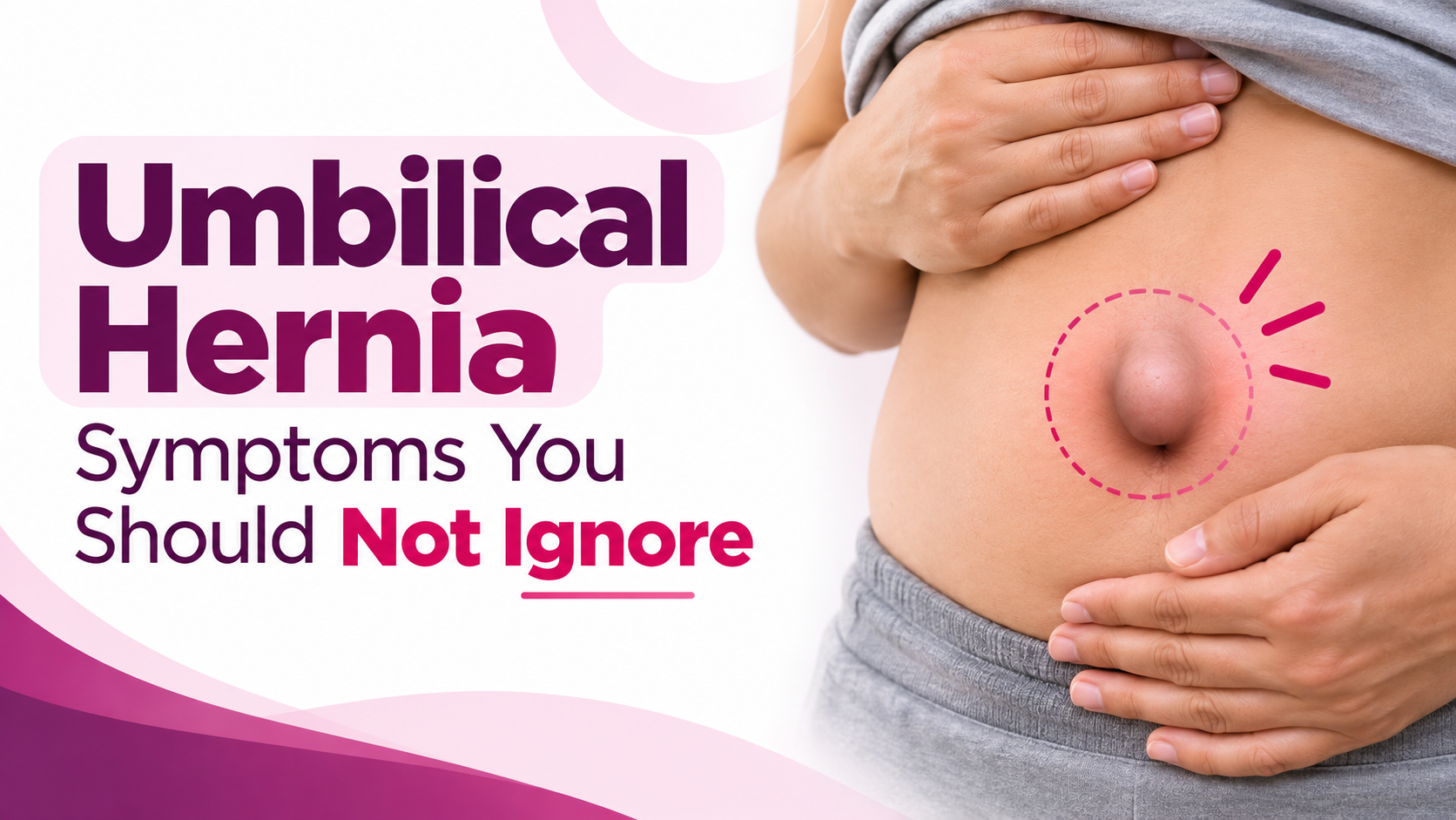 Umbilical Hernia Symptoms